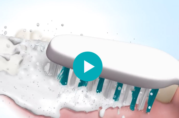 pearlsdents_perlsystem